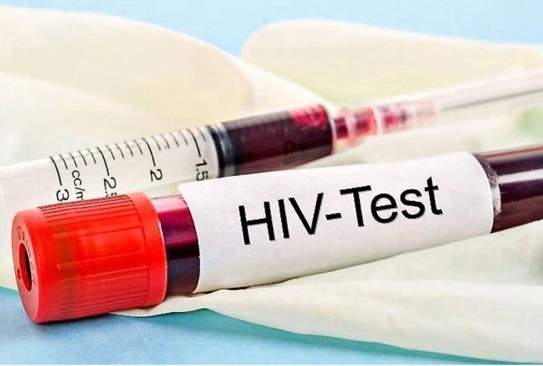 ರಾಜ್ಯಾದ್ಯಂತ ಕಾಲೇಜು ವಿದ್ಯಾರ್ಥಿಗಳಿಗೆ ಹೆಚ್‌ಐವಿ HIV ಪರೀಕ್ಷೆ ನಡೆಸಲು ತೀರ್ಮಾನ!